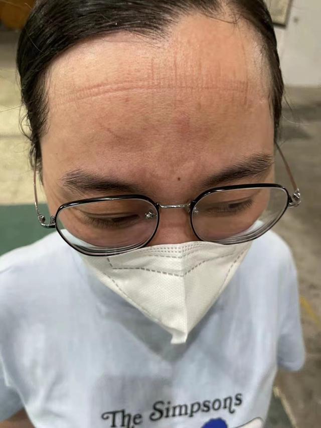  清晨意甲焦点战；北京首钢单刀错失；媒体盛赞；医务组通报恢复